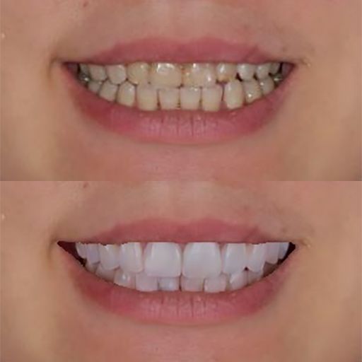 Dental Simulation - Example 3
