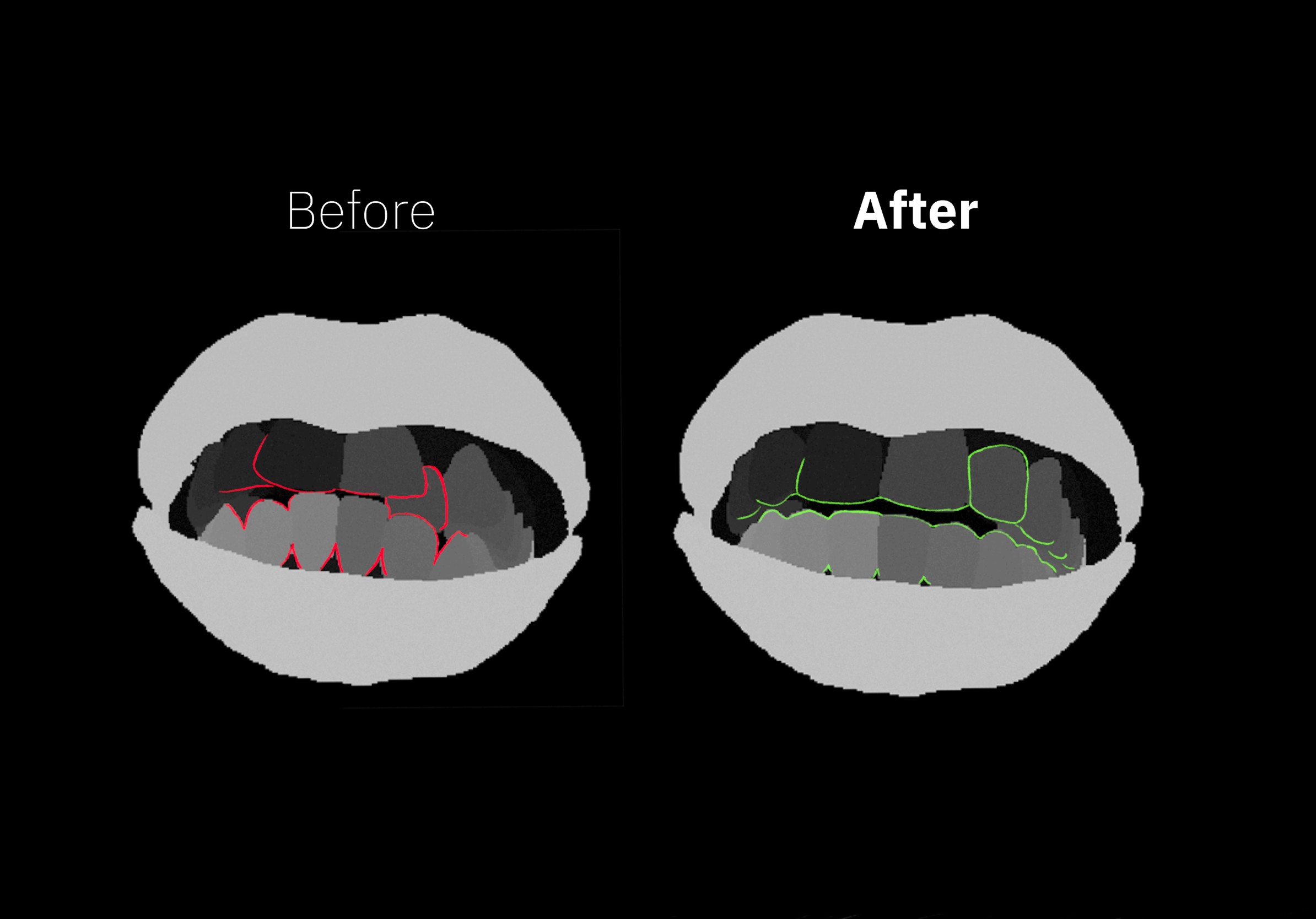 Case Study - AI-Generated Dental Simulation